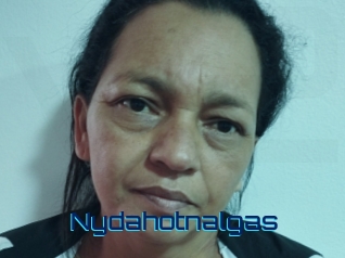 Nydahotnalgas