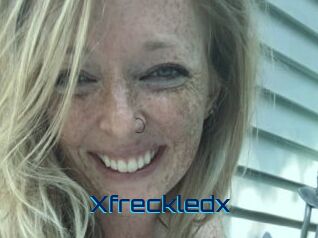 Xfreckledx